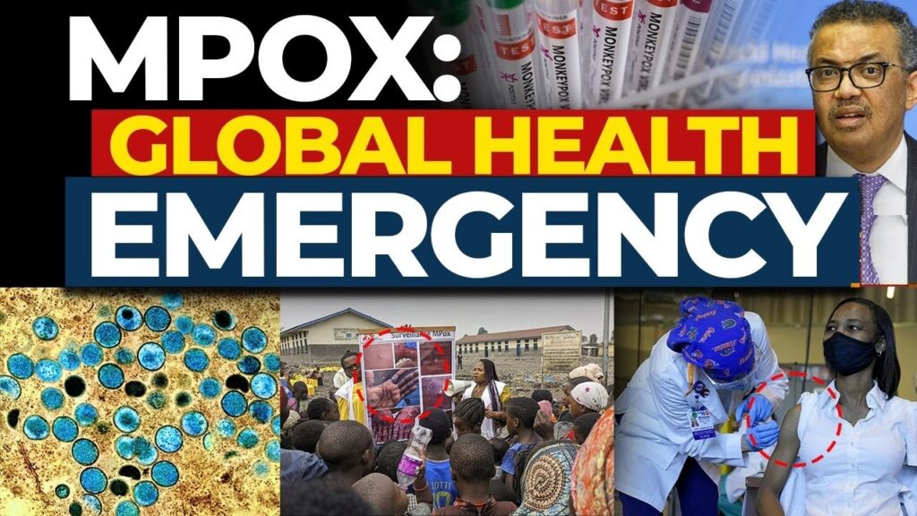 WHO Keeps Mpox as Global Emergengy – Cases on the Rise As a result, the World Health Organization (WHO) has classified the condition as mpox a public health emergency of international concern. We now look back to what fueled such a decision by grappling with the high number of increase in the number of cases and the widespread reach of the virus. Reasons as to why mpox remains in such high global stature The committee comprises of WHO officials as well as independent experts, and this time Whythe WHO Global Mpox Vaccine Boundary meeting was set in Geneva to specifically address the global mpox issues on the 20-21 November. The WHO’s committee joins together to meet and assist the cross barrier condition, which saw them approve the measure in consensus; With a few experts believing that a Degree of Emergency should be retained because: Increased number of cases since last records Traceable contact with the wider spread of the virus Geographical pockets which are making this strain hard to control Countries as well are not in sync which priority and aspects to tackle This Bind draws attention as to why countries are now gradually getting the mpox vaccine boundary in place and looking to tackle this preventing further outbreaks. Mpox: Reappearance in Modern Times: A Regional Perspective The mpox outbreak has consistently grazed the region during the revolutions of the past. The leading mpox cases have been from Congo as well as other regions in Africa in this particular decade. The recent outbreak in Aug 2022 caused concern among the health officials regarding any further recessions of the epidemic. Experts have even warned of a situation where the epidemic could be worse than that of covid-19. Effects in the Affected Countries and areas As seen in the DRC, it was noted that seats in places like Africa had the worst impact of mpox with profound violence. A few hundred deaths have surfaced which places evident pressure on the European Union as well as international aid in order to avoid another similar episode in containment strategies. Pivotal Roll Out of Vaccines and Issues in Distribution Due to there being a rising threat of misbehavior across the region, there was a need to roll out the first batch of vaccines and that was done last month and the goal did in fact seem to be accomplished as early evidence suggests otherwise but it is starting evidence. The WHO has sayed that there is more need to be done and more evidence means more assurance. In these regions it is ensured that there is an intent to possess resiliente settings, but it is still a major challenge to make items of desired access available equally. Explaining the Nature of Mpox: Causes and Effects A rare but noteworthy trait of the Mpox is its ability to become fatal, albeit severe. The Mpox virus is largely acquired by close interactions with infected individuals which include the following: Sweating together or even the slightest of contact between their skins Any form of sexual intercourse One’s lungs absorbing any infectious droplets from the air Once the virus finds its way into the human’s body, it begins replicating and targeting lymph nodes within the body which eventually leads to some inflammation. Swelling of the lymphatic system is common and the body develops rashes or lesions around that area. The Urgent Appeal for A Global Response The crisis caused by mpox can definitely be dealt with through the following strategies: Reforming the existing reporting and analyzing systems Ensuring adequate distribution of antiviral measures and vaccines Making the general public aware of precautions Providing Affected Areas With More Facilities And Support The Concluding Points Mpox is particularly a serious disease in Africa and needs to be addressed as a global threat. The global pandemic has created urgency with the WHO recently deciding to keep hui on a level one alert, and this alone is a signal that there is more to be done on a global scale that can go towards the prevention. An emphasis on vaccination, education by reallocating means and resources globally can help prevent future issues related to this illness.