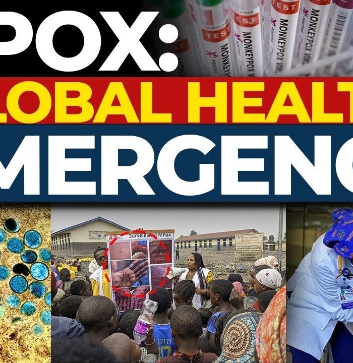 WHO Keeps Mpox as Global Emergengy – Cases on the Rise As a result, the World Health Organization (WHO) has classified the condition as mpox a public health emergency of international concern. We now look back to what fueled such a decision by grappling with the high number of increase in the number of cases and the widespread reach of the virus. Reasons as to why mpox remains in such high global stature The committee comprises of WHO officials as well as independent experts, and this time Whythe WHO Global Mpox Vaccine Boundary meeting was set in Geneva to specifically address the global mpox issues on the 20-21 November. The WHO’s committee joins together to meet and assist the cross barrier condition, which saw them approve the measure in consensus; With a few experts believing that a Degree of Emergency should be retained because: Increased number of cases since last records Traceable contact with the wider spread of the virus Geographical pockets which are making this strain hard to control Countries as well are not in sync which priority and aspects to tackle This Bind draws attention as to why countries are now gradually getting the mpox vaccine boundary in place and looking to tackle this preventing further outbreaks. Mpox: Reappearance in Modern Times: A Regional Perspective The mpox outbreak has consistently grazed the region during the revolutions of the past. The leading mpox cases have been from Congo as well as other regions in Africa in this particular decade. The recent outbreak in Aug 2022 caused concern among the health officials regarding any further recessions of the epidemic. Experts have even warned of a situation where the epidemic could be worse than that of covid-19. Effects in the Affected Countries and areas As seen in the DRC, it was noted that seats in places like Africa had the worst impact of mpox with profound violence. A few hundred deaths have surfaced which places evident pressure on the European Union as well as international aid in order to avoid another similar episode in containment strategies. Pivotal Roll Out of Vaccines and Issues in Distribution Due to there being a rising threat of misbehavior across the region, there was a need to roll out the first batch of vaccines and that was done last month and the goal did in fact seem to be accomplished as early evidence suggests otherwise but it is starting evidence. The WHO has sayed that there is more need to be done and more evidence means more assurance. In these regions it is ensured that there is an intent to possess resiliente settings, but it is still a major challenge to make items of desired access available equally. Explaining the Nature of Mpox: Causes and Effects A rare but noteworthy trait of the Mpox is its ability to become fatal, albeit severe. The Mpox virus is largely acquired by close interactions with infected individuals which include the following: Sweating together or even the slightest of contact between their skins Any form of sexual intercourse One’s lungs absorbing any infectious droplets from the air Once the virus finds its way into the human’s body, it begins replicating and targeting lymph nodes within the body which eventually leads to some inflammation. Swelling of the lymphatic system is common and the body develops rashes or lesions around that area. The Urgent Appeal for A Global Response The crisis caused by mpox can definitely be dealt with through the following strategies: Reforming the existing reporting and analyzing systems Ensuring adequate distribution of antiviral measures and vaccines Making the general public aware of precautions Providing Affected Areas With More Facilities And Support The Concluding Points Mpox is particularly a serious disease in Africa and needs to be addressed as a global threat. The global pandemic has created urgency with the WHO recently deciding to keep hui on a level one alert, and this alone is a signal that there is more to be done on a global scale that can go towards the prevention. An emphasis on vaccination, education by reallocating means and resources globally can help prevent future issues related to this illness.