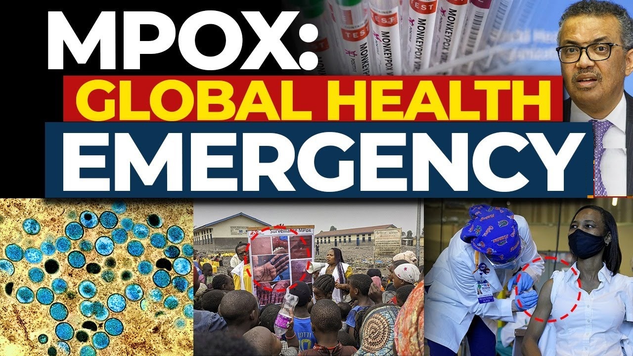 WHO Keeps MPOX as Global Emergency Cases on the Rise